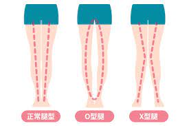 改善腳型的秘訣