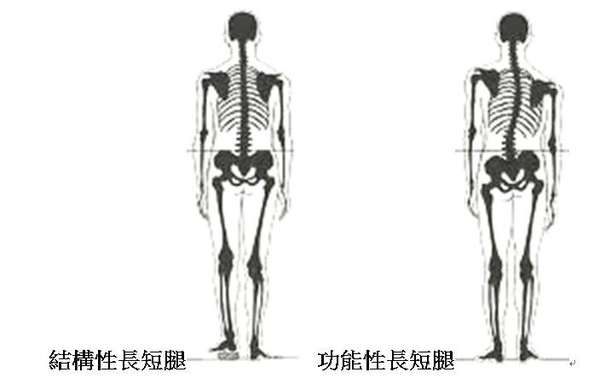 長短腳亦有真有假？