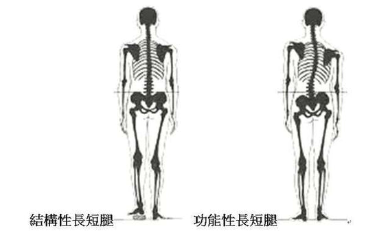 長短腳亦有真有假？